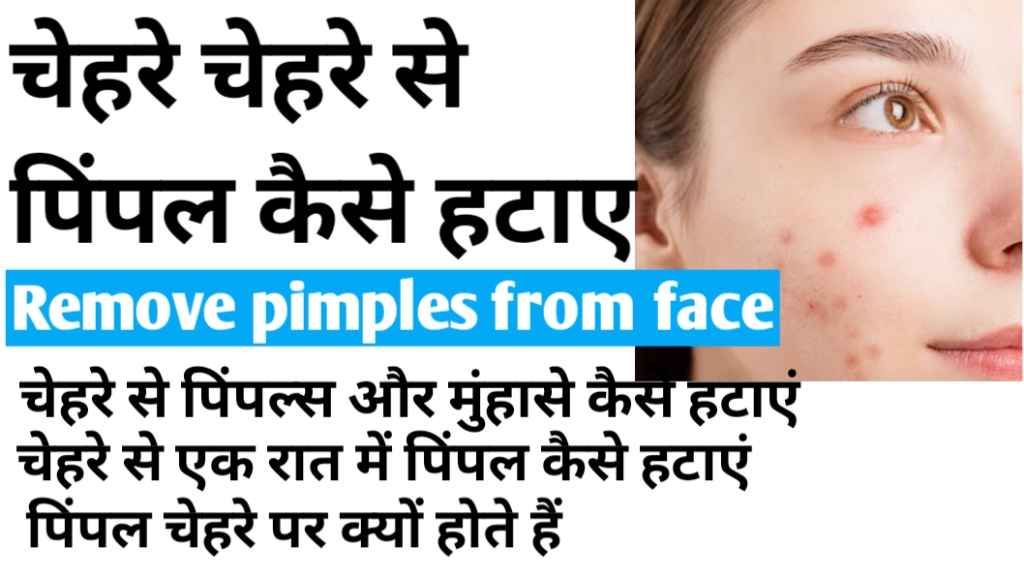 चेहरे से पिंपल कैसे हटाए घरेलू उपाय, how to remove pimples from face