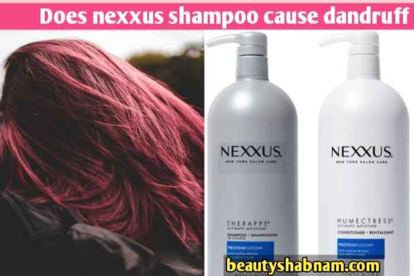 Does nexxus shampoo cause dandruff