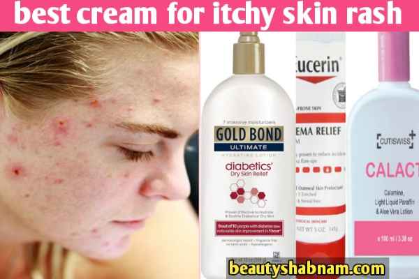 best cream for itchy skin rash